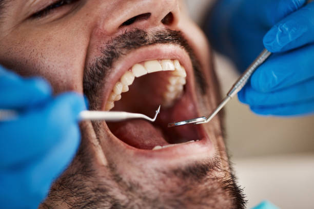 Best Dental Exams and Cleanings  in Lucerne, CA